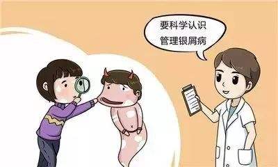 牛皮癣的预防措施有哪些