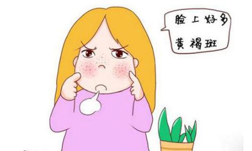 怎么去除黄褐斑呢