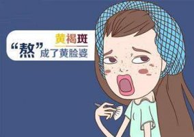 黄褐斑对肌肤有什么伤害