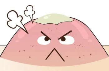 不同部位的痘痘是怎么回事